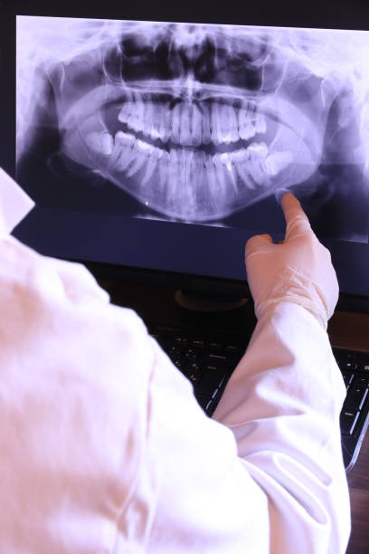 Best Emergency Treatment for Dental Infections or Abscesses in Greilickville, MI