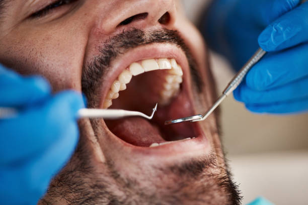 Best Urgent Care for Lost Fillings or Crowns in Greilickville, MI